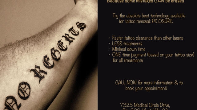 Tca Tattoo Removal – Ideal For Removing Leg Tattoos