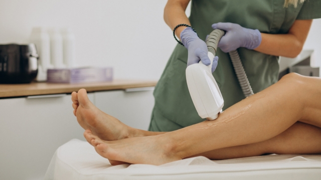 Liberating Smoothness: Unveiling the Magic of Laser Hair Removal